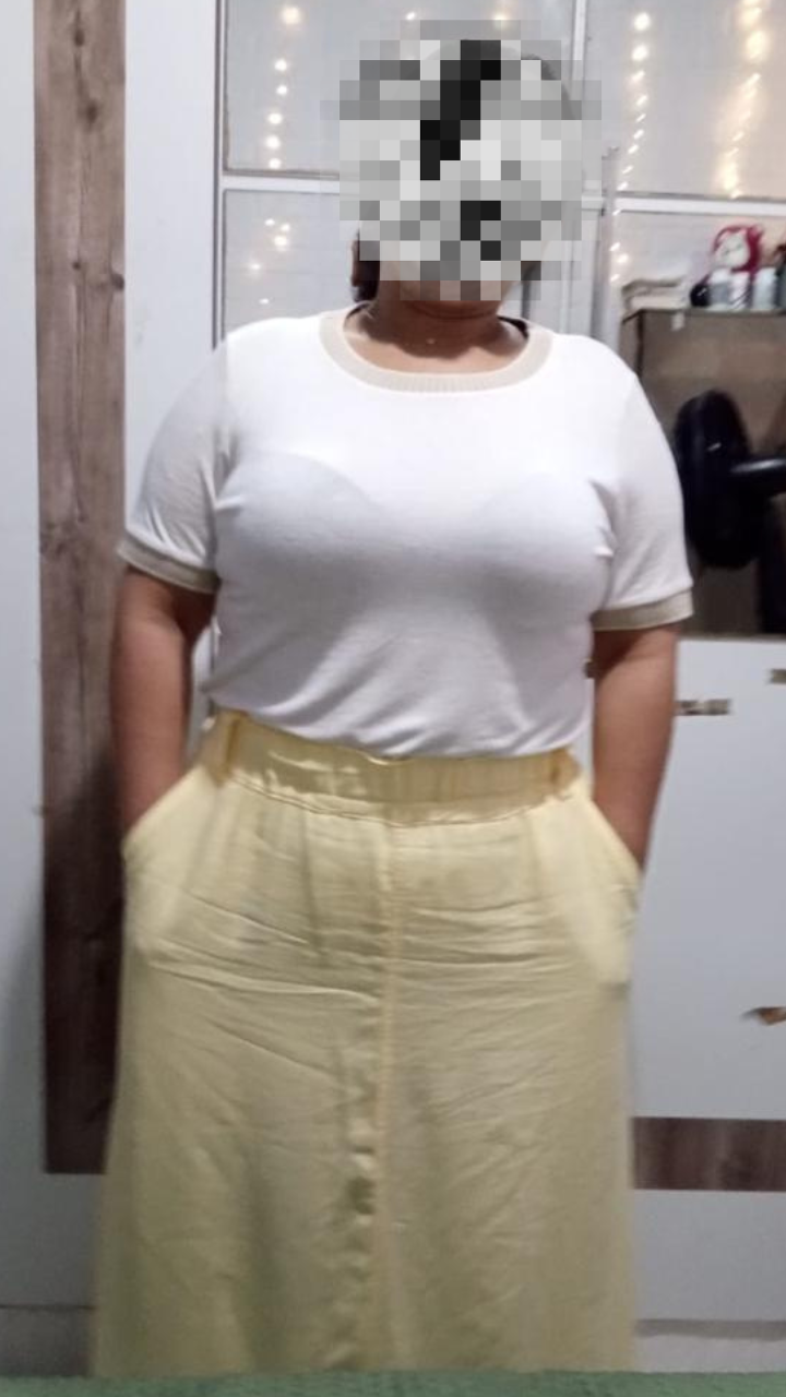 Antes e Depois 1