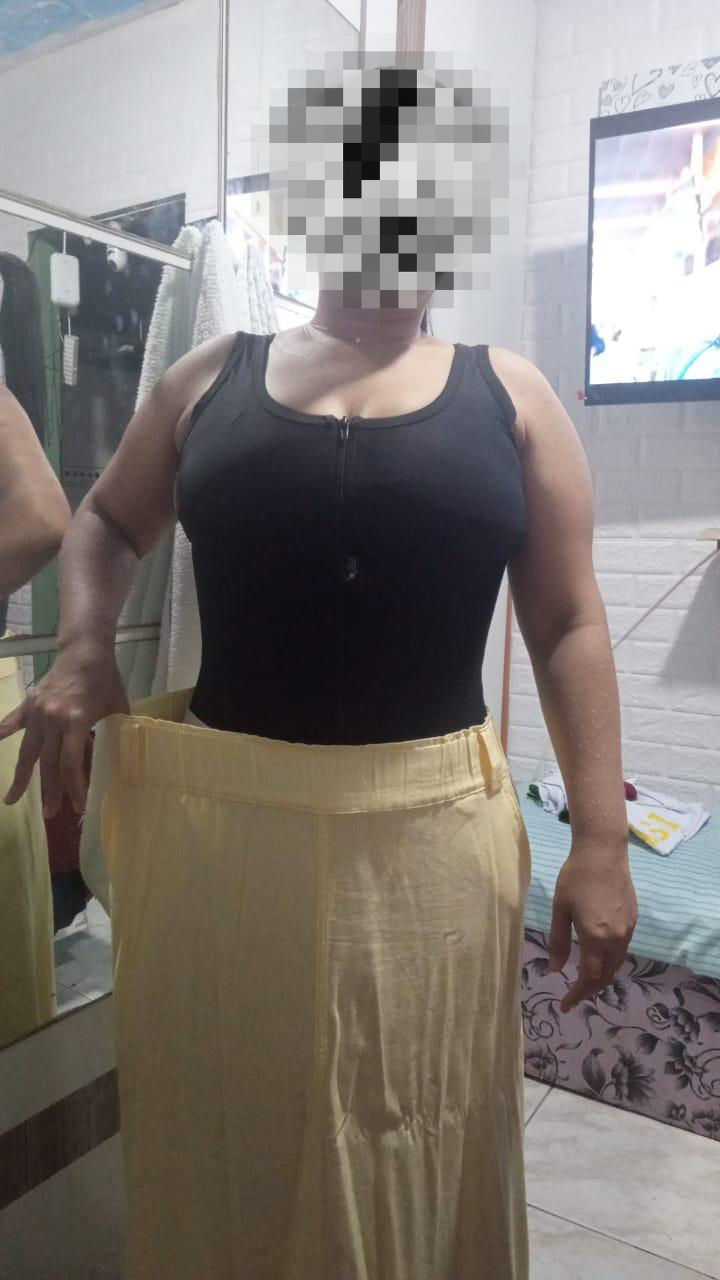 Antes e Depois 2
